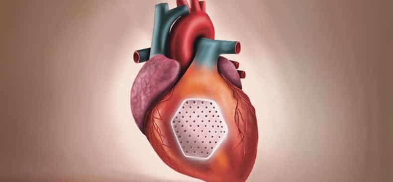 Parche de Células Madre: La Revolucionaria Terapia que Repara Corazones Dañados 6 parche